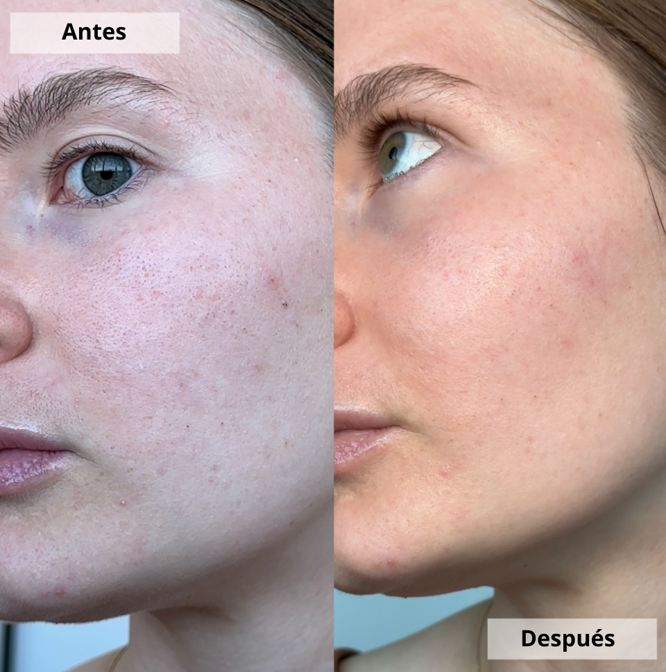 Limpiador de poros Zalery®